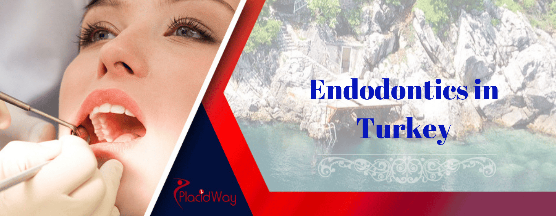 Endodontics in Turkey